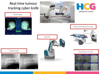 Rrecent advances in linear accelerators [MR linac] | PPTX