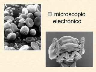 El microscopio
electrónico
 