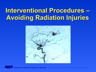 Interventional Procedures – Avoiding Radiation Injuries 