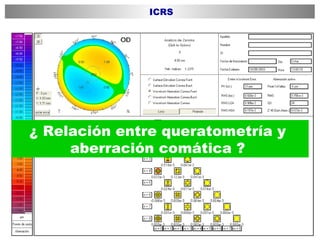 ¿ Relación entre queratometría y  aberración comática ?  ICRS 
