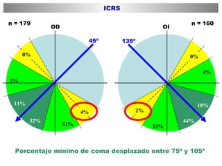 Porcentaje mínimo de coma desplazado entre 75º y 105º  OI 135º 44% 18% 33% 0% 4% OD 51% 32% 11% 2% 45º 0% 4% 2% n = 160 n = 179 ICRS 