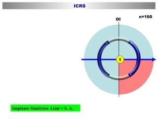 Implante Simétrico Axial = S. A. OI n=160 ICRS 1 