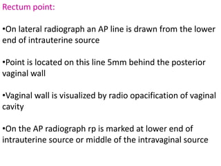 Rectum point:
•On lateral radiograph an AP line is drawn from the lower
end of intrauterine source
•Point is located on this line 5mm behind the posterior
vaginal wall
•Vaginal wall is visualized by radio opacification of vaginal
cavity
•On the AP radiograph rp is marked at lower end of
intrauterine source or middle of the intravaginal source
 