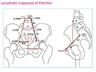 Lymphatic trapezoid of Fletcher:
 