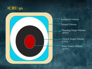 ICRU 50
Irradiated Volume
Treated Volume
Planning Target Volume
(PTV)
Clinical Target Volume
(CTV)
Gross Tumor Volume
(GTV)
 