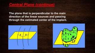 Central Plane (continue)
The plane that is perpendicular to the main
direction of the linear sources and passing
through the estimated center of the implant.
 