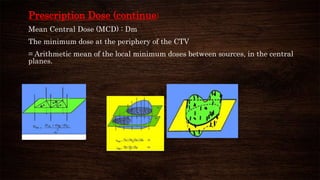 Prescription Dose (continue)
Mean Central Dose (MCD) : Dm
The minimum dose at the periphery of the CTV
= Arithmetic mean of the local minimum doses between sources, in the central
planes.
 