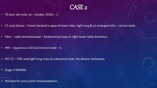 CASE 2
• 70 year old male, ex – smoker, ECOG – 1.
• CT scan thorax – Tumor located in apex of lower lobe, right lung & an enlarged infra – carinal node.
• Fiber – optic bronchoscopy – Endoluminal mass in right lower lobar bronchus.
• HPE – Squamous Cell Carcinoma Grade – II.
• PET CT – FDG avid right lung mass & subcarinal node. No distant metastasis.
• Stage cT3N2M0.
• Planned for concurrent chemoradiation.
 