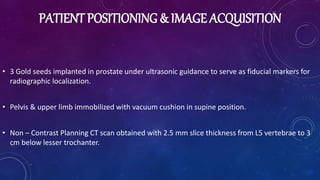 PATIENT POSITIONING & IMAGE ACQUISITION
• 3 Gold seeds implanted in prostate under ultrasonic guidance to serve as fiducial markers for
radiographic localization.
• Pelvis & upper limb immobilized with vacuum cushion in supine position.
• Non – Contrast Planning CT scan obtained with 2.5 mm slice thickness from L5 vertebrae to 3
cm below lesser trochanter.
 