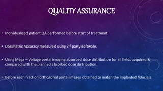 QUALITY ASSURANCE
• Individualized patient QA performed before start of treatment.
• Dosimetric Accuracy measured using 3rd party software.
• Using Mega – Voltage portal imaging absorbed dose distribution for all fields acquired &
compared with the planned absorbed dose distribution.
• Before each fraction orthogonal portal images obtained to match the implanted fiducials.
 