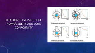 DIFFERENT LEVELS OF DOSE
HOMOGENEITY AND DOSE
CONFORMITY
 