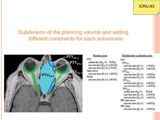 Subdivision of the planning volume and setting
different constraints for each subvolume
ICRU-83
 