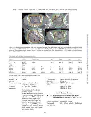 might use ﬁxed margins to the OAR and targets to
deﬁne automatically the active positions to be used for
further dwell-time optimization (auto-margins).
As an alternative to standard dwell positions and
dwell weights in a standard loading, many facilities
use optimization goals relative to the applicator
(Nag et al., 2000; Thomadsen, 1995). This approach
is particularly useful for applicators without ﬁxed
relationships between the parts or when the treated
length, for instance, in the tandem is adjusted for in-
dividual patients.
Because all the approaches described above create
absorbed-dose distributions based on the applicator,
following any of them results in highly variable
absorbed dose in the CTVHR. In general, when using
standardized approaches, tumors with a radial width
less than 2 cm tend to receive absorbed doses signiﬁ-
cantly higher than the Point A absorbed dose,
whereas those with more than 2 cm receive a lower
absorbed dose (Tanderup et al., 2010a). Furthermore,
the OARs tend to be closer to the implant in small-
volume tumors, which means that OAR constraints
are more often violated for small tumors when stan-
dardized approaches are applied.
12.4 Optimization of the Dose Distribution
12.4.1 General aspects of dose optimization
At present, dose planning for cervical brachyther-
apy is based on a limited number of dose–volume
constraints and planning aims. Simple techniques
have been based on the TRAK (formerly expressed
in mg Ra), the absorbed dose to single points (e.g.,
Point A), or the dimensions of reference isodose lines
(e.g., 60 Gy). For the OAR, radiographic planning
provides additional points for dose assessment. With
the use of DVHs, not only single-point absorbed
doses, but dose–volume relationships can be
expressed both for the target and for the OARs
(rectum, sigmoid, bowel, bladder) and used as dose
constraints for planning, recording, and reporting
(see Section 8). However, the spatial distribution of
absorbed dose is not fully described either by a set of
dose points distributed throughout the treated
volume or by any DVH.
An intracavitary implant produces a high-absorbed-
dose region located around the applicators, in most
cases enclosing the GTV and the CTVHR. Combination
treatments with interstitial needles should therefore
maintain the high-absorbed-dose region located
around the intrauterine channel because high
absorbed doses in the center of the CTV seem to be
more effective in terms of local control compared with
homogenous absorbed-dose proﬁles (Viswanathan
et al., 2009). At the level of the lower cervix and upper
vagina, the lateral width of the isodose pattern is
larger than the antero-posterior thickness in order to
spare the bladder and the rectum. Three-dimensional
dose recommendations have been used for the rectum,
sigmoid, and bladder, but not yet for the vagina
(Lindegaard et al., 2013; Po¨tter et al., 2011). The situ-
ation is more complex for the vagina, which in addition
to being an OAR also might be part of the brachyther-
apy target. Some traditional treatment approaches
have used absorbed dose to vaginal points as con-
straints. This is also emphasized in this report, even to
validate a 3D approach. In addition, there are regions
around target volumes and contoured OARs (e.g., the
connective tissue around the uterus, the ureter, the
urethra, nerves, and blood vessels where absorbed
doses are not assessed). As no 3D-contouring recom-
mendations have been deﬁned so far, no dosimetric
parameters and constraints are suggested for these
structures. However, with the standard loading pat-
terns and standardized absorbed-dose distributions,
there is a large clinical experience showing that these
absorbed-dose distributions are only rarely linked to
major morbidity in these structures. Standard
absorbed-dose distributions also deliver very high
absorbed doses to the mucosa of the uterus, adjacent
stroma, and whole cervix, but more moderate absorbed
doses to the more distant uterine stroma, parame-
trium, rectum, bladder, sigmoid, nerves, vessels,
urethra, and ureter. High absorbed dose occurs also in
the vaginal mucosa due to the close proximity to the
sources. Future research work should determine how
to reduce the vaginal absorbed dose under certain clin-
ical conditions (e.g., cases with no apparent involve-
ment of the vagina). At present, most centers maintain
a conservative loading pattern along the caudal border
of the CTVHR leading to relative large margins
between the CTVHR and the treated volume.
If the cranial part of the CTVHR does not reach far
into the uterine corpus, loading patterns for cervical
brachytherapy might not need to include the full
length of the intrauterine applicator. Avoiding dwells
high in the tandem without compromising the
CTVHR is advantageous, as the sigmoid and small
bowel are often close to the applicator in that region.
Reducing the superior dwells in the tandem must be
done with caution if only CT is used for imaging, as
this modality usually does not allow for a clear deﬁn-
ition of the cranial extent of the cervical tumor.
However, as uncertainties in applicator reconstruc-
tion unfortunately are most pronounced in the same
direction, the intrauterine tip loading should not
differ substantially from conventional standard
loading for which there is no need for sigmoid
absorbed-dose reduction (see Sections 5.4.6 and 5.5).
The use of image-deﬁned, anatomy-based loading
patterns can improve the absorbed-dose distribution
Treatment Planning
157
atUniversityofCalifornia,IrvineonSeptember9,2016http://jicru.oxfordjournals.org/Downloadedfrom
 