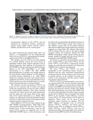 compartments adjacent to the CTV-T2 and not
separated by anatomical borders: parametria,
uterine corpus, upper vagina, anterior uterus–
bladder, and posterior cervix–rectum space.
For early brachytherapy (limited Stage IB1), the
CTV-T1-3 is recommended, for late brachytherapy
(IB2), the use of CTV-T3 is recommended for design-
ing the initial CTV-T3 for EBRT (CTV-TLR).
The margins above for CTV-T2 have been deﬁned
at a certain distance around the cervix based on
pathologic evidence from surgical specimens and on
clinical experience from patterns of recurrences by
GEC ESTRO in Europe and American Brachytherapy
Society in the USA (Haie-Meder et al., 2005;
Viswanathan et al., 2012b). The GEC ESTRO
Recommendations on margins were mainly based on
the long French clinical tradition in CTV deﬁnition
in limited disease (Gerbaulet et al., 1995; 2002a)
(Figures 5.7 and 5.8). An extra 5 mm margin may be
applied for the CTV-T2 in the assumed direction of po-
tential spread in the case of speciﬁc risks (e.g., macro-
scopic tumor growth close to a uterine border).
The selection and the contouring of CTV-T3 are
based on the assumed risk of tumor cell spread
within the compartments at risk (see above). Within
the long-standing traditions, this target includes
at present: the whole uterus, the whole parametria,
and the upper part, the upper third or the upper
half, of the vagina (Gerbaulet et al., 2002a). More
evidence on appropriate and individualized margins
will have to come from clinical and imaging studies
relating margins to clinical outcome.
Three different CTV-Ts have been deﬁned in the
GEC ESTRO recommendations: “High Risk CTV,”
“Intermediate Risk CTV,” and “Low risk CTV” (see
Section 5.4.5). If this terminology is used for the
initial CTV-T concept as suggested also in this
ICRU/GEC ESTRO report, a clear distinction must
be made to the corresponding risk deﬁnitions based on
the adaptive CTV-T target concept. The volumes of
the adaptive concept refer to the clinical situation
after chemo-radiotherapy which implies the treatment
response as a major factor. The volumes of the initial
CTV-T concept, however, refer to the initial clinical
situation without any treatment. Ideally, the GEC
ESTRO terminology, widely spread during the last
decade, should be merged with the terms CTV-T1-3
developed in this ICRU/GEC ESTRO report.
For clarity, it is therefore recommended to use the
terms “initial CTVHR” and “initial CTVIR” for the
terms “CTV-T1” and “CTV-T2”, respectively, if these
targets are selected and contoured at the beginning
of EBRT with or without chemotherapy.
The terms “CTVLR” and “CTV-T3” are inter-
changeable as the underlying volume concept is
identical with the same anatomical compartments
needing treatment. Some changes may be observed
in speciﬁc volumes, as, for example, the shape and
volume of the parametria and the uterine corpus
may change with treatment.
CTV-TLR (CTV-T3) is recommended in any case as
the tumor-related CTV for the treatment planning
of EBRT. This applies to limited disease Stage IB1
treated with EBRT and brachytherapy from the be-
ginning and extensive disease treated with EBRT
ﬁrst and brachytherapy as a boost after EBRT with
or without chemotherapy. The other target concepts
can be used in addition: the one related to the initial
GTV-T as, for example, “initial CTV-THR” and the
“initial CTVIR” for tumor-related CTV margins at
diagnosis. These terms can be used in more
advanced stages requiring an adaptive CTV for
EBRT (Figures 5.9 through 5.12). In advanced
disease, CTV-TLR, CTV-THR, and CTVIR may be
deﬁned at the start of treatment (initial CTV-TLR,
initial CTV-THR, initial CTV-TIR) and may be
adapted according to the topographic and volumetric
changes during EBRT and also at brachytherapy.
Figure 5.7. Magnetic resonance imaging at diagnosis of Stage IIB cervical cancer inﬁltrating both parametria with GTV-Tinit and
CTV-TLR (CTV-T3) including both parametria, uterine corpus, and upper vagina, contoured for treatment planning of EBRT.
PRESCRIBING, RECORDING, AND REPORTING BRACHYTHERAPY FOR CANCER OF THE CERVIX
62
atUniversityofCalifornia,IrvineonSeptember9,2016http://jicru.oxfordjournals.org/Downloadedfrom
 
