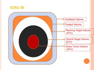 ICRU 50
Irradiated Volume
Treated Volume
Planning Target Volume
(PTV)
Clinical Target Volume
(CTV)
Gross Tumor Volume
(GTV)
 