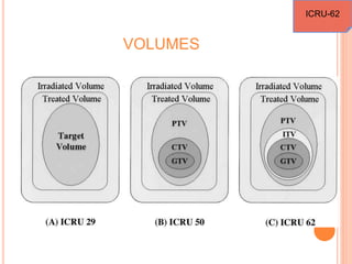 VOLUMES
ICRU-62
 