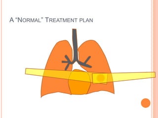 A “NORMAL” TREATMENT PLAN
 