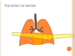 THE EFFECT OF MOTION
 