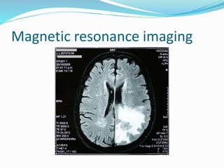 Magnetic resonance imaging
 