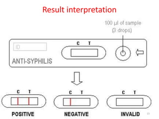 Result interpretation
13
 