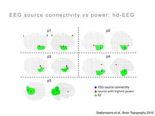 Ictal EEG source imaging | PPTX