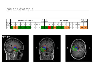 Ictal EEG source imaging | PPTX