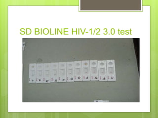 SD BIOLINE HIV-1/2 3.0 test
 