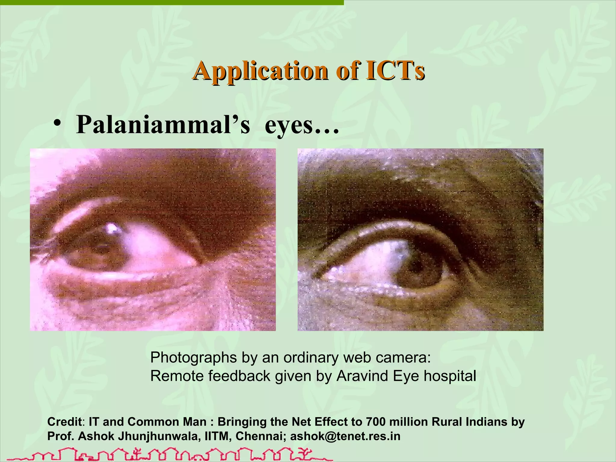 Palaniammal’s  eyes… Application of ICTs Photographs by an ordinary web camera: Remote feedback given by Aravind Eye hospital Credit :  IT and Common Man :  Bringing the Net Effect to 700 million Rural Indians by Prof. Ashok Jhunjhunwala, IITM, Chennai; ashok@tenet.res.in 