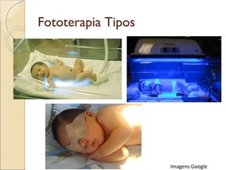 Fototerapia Tipos




                    Imagens Google
 