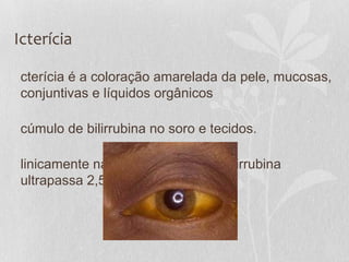 Icterícia
cterícia é a coloração amarelada da pele, mucosas,
conjuntivas e líquidos orgânicos
cúmulo de bilirrubina no soro e tecidos.
linicamente na pele e mucosas – bilirrubina
ultrapassa 2,5 mg % no sangue.
 