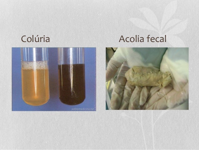 ACOLIA COLURIA EPUB DOWNLOAD ACOLIA COLURIA EPUB DOWNLOAD