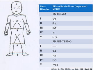 Quadro Clínico
A progressão da icterícia é CÉFALO-CAUDAL, como
descrito em 1929 por Rolleston e McNee.
Em 1969, Kramer demonstrou uma relação entre a
progressão da icterícia e o aumento dos valores
séricos de bilirrubina.
Zonas de Kramer
Zona
Dérmica
Bilirrubina indireta (mg/100ml)
MÉDIA
RN TERMO
I 5,9
II 8,9
III 11,8
IV 15
V > 15
RN PRÉ-TERMO
I ----
II 9,4
III 11,4
IV 13,3
V >13,3
 