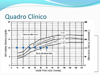 Quadro Clínico
Os casos de Icterícia neonatal que sugerem origem não
fisiológica deverão ser avaliados através de exames
complementares.
 Segundo a SBP, a rotina recomendada é:
As principais indicações de avaliação laboratorial
são:
•Icterícia com inicio nas primeiras 24h de vida;
•Icterícia em RN aparentemente doente;
•Sinais de hemólise: palidez e hepatoesplenomegalia;
•Icterícia evidente até a metade do abdome (zona III)
•Incompatibilidade ABO/Rh já conhecida;
•Irmão que tenha necessitado de fototerapia;
•Céfalo-hematoma ou sangramento signifcativo
 