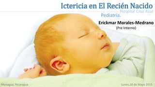 Ictericia en El Recién Nacido
Managua, Nicaragua Lunes,18 de Mayo 2015
Hospital Cruz Azul
Erickmar Morales-Medrano
(Pre Interno)
Pediatría.
 