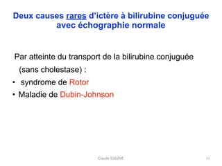 Claude EUGENE
Deux causes rares d’ictère à bilirubine conjuguée 
avec échographie normale
Par atteinte du transport de la bilirubine conjuguée
(sans cholestase) :
• syndrome de Rotor
• Maladie de Dubin-Johnson
11
 