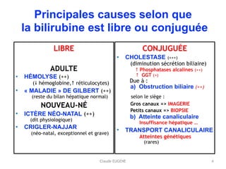 Claude EUGENE
Principales causes selon que 
la bilirubine est libre ou conjuguée
LIBRE
ADULTE
• HÉMOLYSE (++) 
(! hémoglobine," réticulocytes)
• « MALADIE » DE GILBERT (++) 
(reste du bilan hépatique normal)
NOUVEAU-NÉ
• ICTÈRE NÉO-NATAL (++) 
(dit physiologique)
• CRIGLER-NAJJAR 
(néo-natal, exceptionnel et grave)
CONJUGUÉE
• CHOLESTASE (+++) 
(diminution sécrétion biliaire) 
" Phosphatases alcalines (++) 
" GGT (+) 
Due à : 
a) Obstruction biliaire (++)
selon le siège :
Gros canaux => IMAGERIE
Petits canaux => BIOPSIE 
b) Atteinte canaliculaire
Insuffisance hépatique …
• TRANSPORT CANALICULAIRE 
Atteintes génétiques 
(rares)
4
 