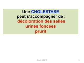 Claude EUGENE
Une CHOLESTASE
peut s’accompagner de :
décoloration des selles
urines foncées
prurit
5
 