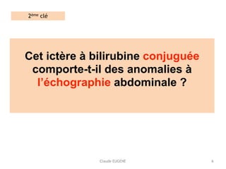 Claude EUGENE
Cet ictère à bilirubine conjuguée
comporte-t-il des anomalies à
l’échographie abdominale ? 
6
2ème clé
 