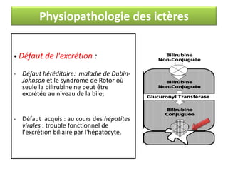 Physiopathologie des ictères
• Défaut de l'excrétion :
- Défaut héréditaire: maladie de DubinJohnson et le syndrome de Rotor où
seule la bilirubine ne peut être
excrétée au niveau de la bile;

- Défaut acquis : au cours des hépatites
virales : trouble fonctionnel de
l'excrétion biliaire par l'hépatocyte.

 