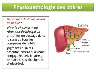 Physiopathologie des ictères
- Anomalies de l'évacuation
de la bile :
c'est la cholestase ou
rétention de bile qui va
entraîner un passage dans
le sang de tous les
composés de la bile :
pigments biliaires
essentiellement bilirubine
conjuguée, sels biliaires,
phosphatases alcalines et
cholestérol.

 