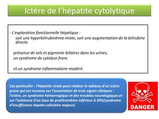 Ictère de l’hépatite cytolytique
- L'exploration fonctionnelle hépatique :
soit une hyperbilirubinémie mixte, soit une augmentation de la bilirubine
directe
présence de sels et pigments biliaires dans les urines,
un syndrome de cytolyse franc
et un syndrome inflammatoire modéré.

Cas particulier : l'hépatite virale peut réaliser le tableau d'un ictère
grave qui est reconnu sur l'association de trois signes cliniques :
l'ictère, un syndrome hémorragique et des troubles neurologiques et
sur l'existence d'un taux de prothrombine inférieur à 30%(syndrome
d'insuffisance hépato-cellulaire majeur).

 
