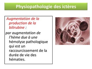 Physiopathologie des ictères
Augmentation de la
production de la
bilirubine :
par augmentation de
l’hème due à une
hémolyse pathologique
qui est un
raccourcissement de la
durée de vie des
hématies.

 