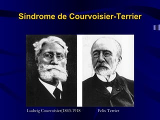 Síndrome de Courvoisier-Terrier




  Ludwig Courvoisier(1843-1918   Felix Terrier
 