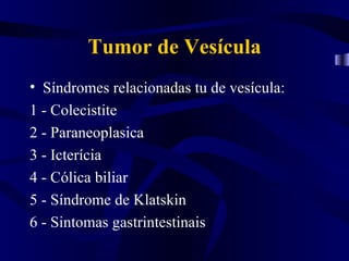 Tumor de Vesícula
• Síndromes relacionadas tu de vesícula:
1 - Colecistite
2 - Paraneoplasica
3 - Icterícia
4 - Cólica biliar
5 - Síndrome de Klatskin
6 - Sintomas gastrintestinais
 