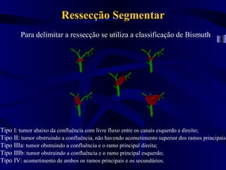 Ressecção Segmentar
        Para delimitar a ressecção se utiliza a classificação de Bismuth




Tipo I: tumor abaixo da confluência com livre fluxo entre os canais esquerdo e direito;
Tipo II: tumor obstruindo a confluência, não havendo acometimento superior dos ramos principais;
Tipo IIIa: tumor obstruindo a confluência e o ramo principal direita;
Tipo IIIb: tumor obstruindo a confluência e o ramo principal esquerdo;
Tipo IV: acometimento de ambos os ramos principais e os secundários.
 