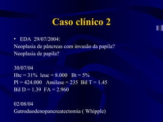 Caso clínico 2
• EDA 29/07/2004:
Neoplasia de pâncreas com invasão da papila?
Neoplasia de papila?

30/07/04
Htc = 31% leuc = 8.000 Bt = 5%
Pl = 424.000 Amilase = 235 Bil T = 1.45
Bil D = 1.39 FA = 2.960

02/08/04
Gatroduodenopancreatectomia ( Whipple)
 