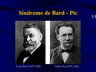 Síndrome de Bard - Pic




Louis Bard-(1857-1930)   Adrien Pic-(1872-1944)
 
