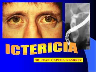 DR: JUAN CAPCHA RAMIREZ
 