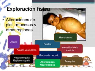 Exploración física
• Alteraciones de
piel, mucosas y
otras regiones
Intensidad de la
ictericia
Palidez
Petequias
Marcas de rascado
Arañas vasculares
Hematomas
Hepatomegalia
Esplenomegalia
Ascitis
Alteraciones
Neurológicas
 