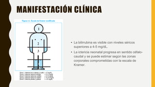 MANIFESTACIÓN CLÍNICA
• La bilirrubina es visible con niveles séricos
superiores a 4-5 mg/dL.
• La ictericia neonatal progresa en sentido céfalo-
caudal y se puede estimar según las zonas
corporales comprometidas con la escala de
Kramer.
 